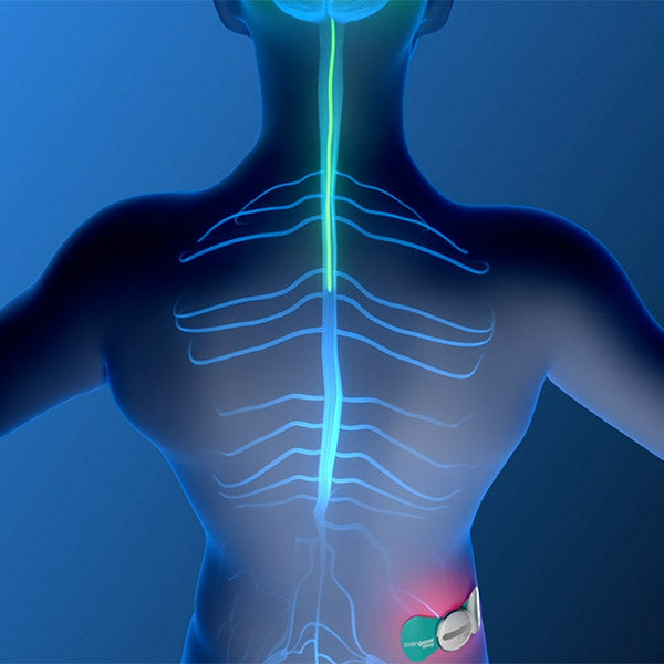 Easy Tens Device for Daily Pain